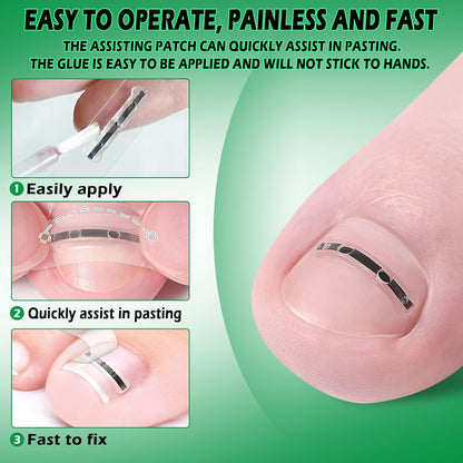 Nail Correction Patch and Retainer Set