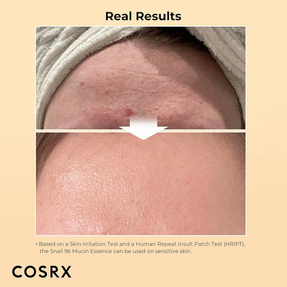 COSRX Snail Mucin 96% Power Face Serum